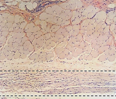 Rabbit injection-site histology after SC injection with hyaluronidase: fibroplasia in the subcutis, marked by a dashed box